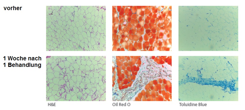 enCurve Apoptose