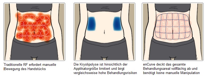 enCurve Vergleich